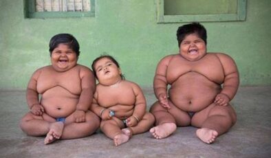 Çocuklarda Obezite Nelerdir? Şişman Bebek Sağlıklı mıdır?