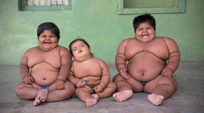 Çocuklarda Obezite Nelerdir? Şişman Bebek Sağlıklı mıdır?