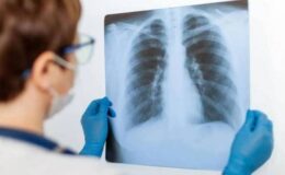 Bronkoskopi (Akciğer Endoskopisi) Nedir? Tanı ve Tedavideki Rolü