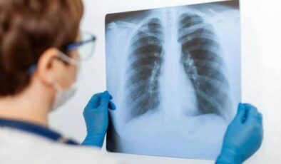 Bronkoskopi (Akciğer Endoskopisi) Nedir? Tanı ve Tedavideki Rolü