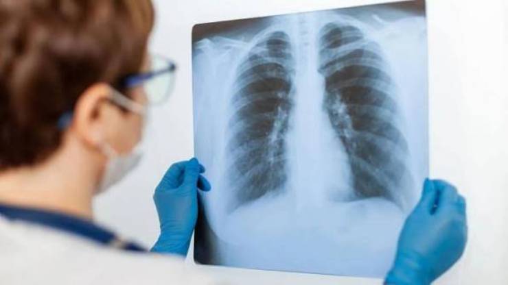 Bronkoskopi (Akciğer Endoskopisi) Nedir? Tanı ve Tedavideki Rolü