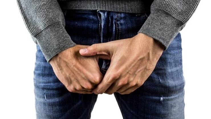 Hidrosel (Testis Torbasında Sıvı Birikimi)