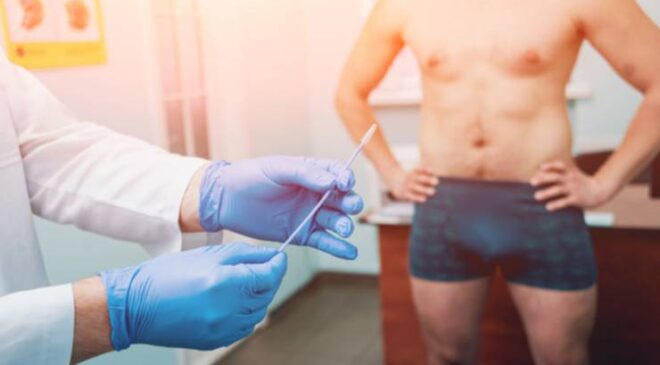 Penis Kanseri: Belirtileri, Teşhis ve Tedavi Yöntemleri