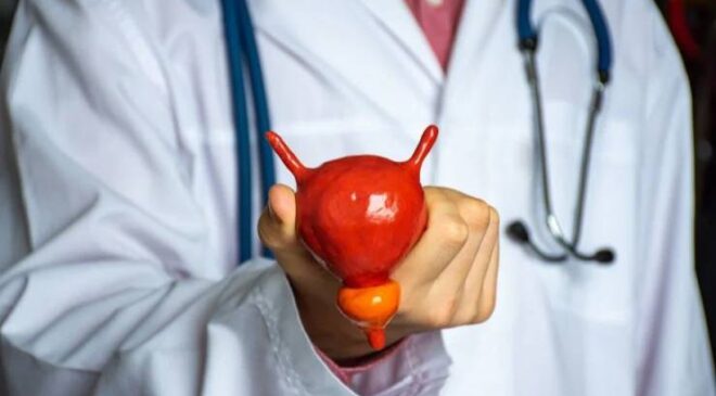 Prostat Tedavisinde Cinsel Sağlığı Korumanın Yolları