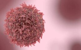 Bilim İnsanları Çözemiyor 50 Yaş Altı Kişilerde Kanser Vakaları Artıyor