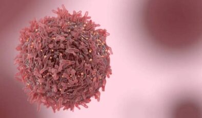 Bilim İnsanları Çözemiyor 50 Yaş Altı Kişilerde Kanser Vakaları Artıyor