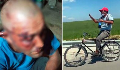 Ceyhan’da Zihinsel Engelli Ünlü Fenomene Çirkin Saldırı