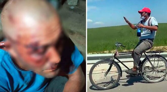 Ceyhan’da Zihinsel Engelli Ünlü Fenomene Çirkin Saldırı