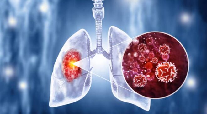 Kanserin Sebebi Nedir ve Nasıl Gelişir?