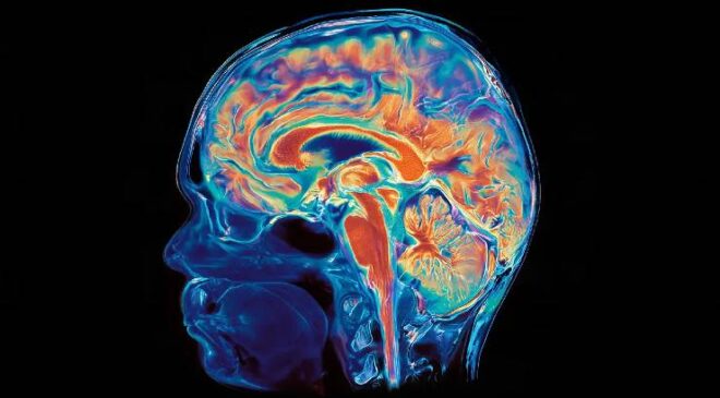 Stanford Araştırması Ezber Bozdu: İnsan Beyni İki Ayrı Organ Olabilir