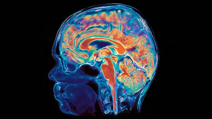 Stanford Araştırması Ezber Bozdu: İnsan Beyni İki Ayrı Organ Olabilir