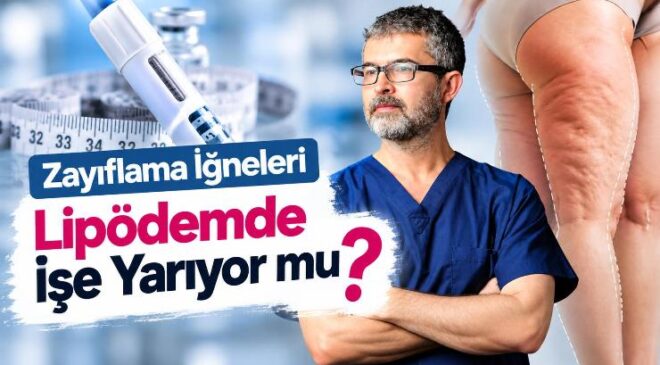 Zayıflama İğneleri Lipödemde İşe Yarıyor mu? Yeni Araştırmalar Lenf Sistemine İşaret Ediyor